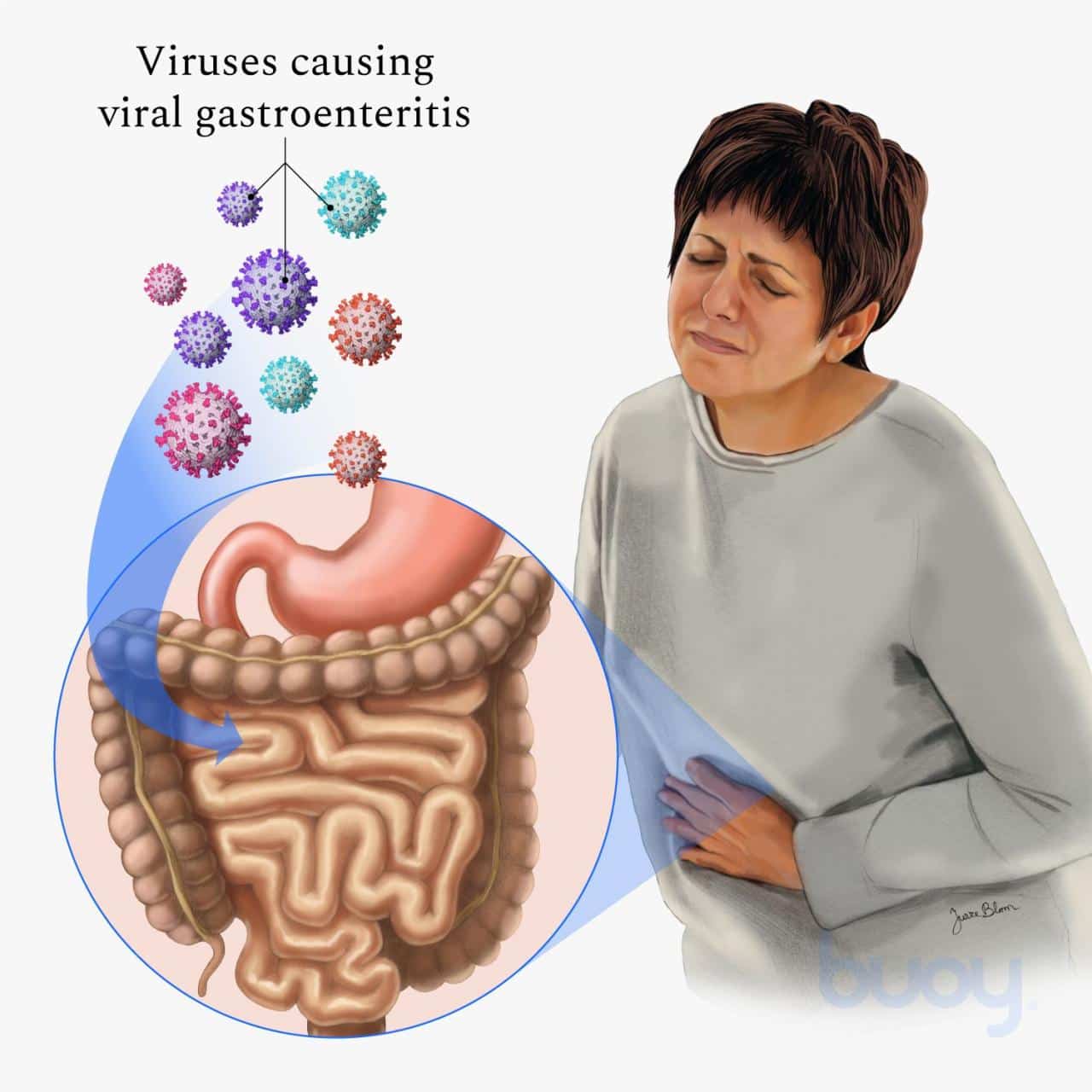 Stomach Virus October 2024