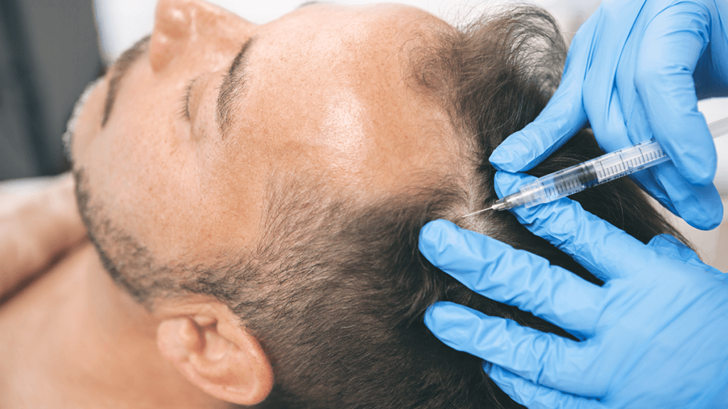 Dermatologist Hair Loss Near Me