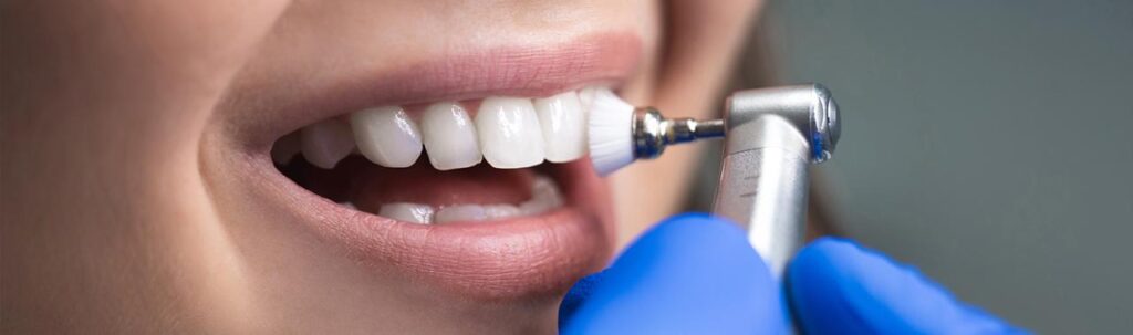 Dental Cleaning Cost Near Me