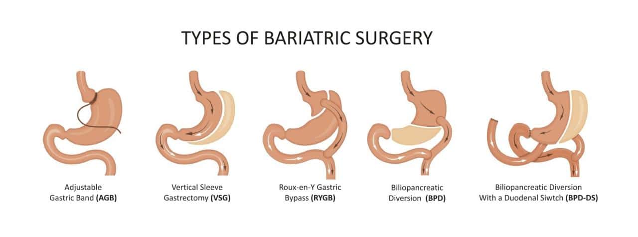 Bariatric Clinics Near Me