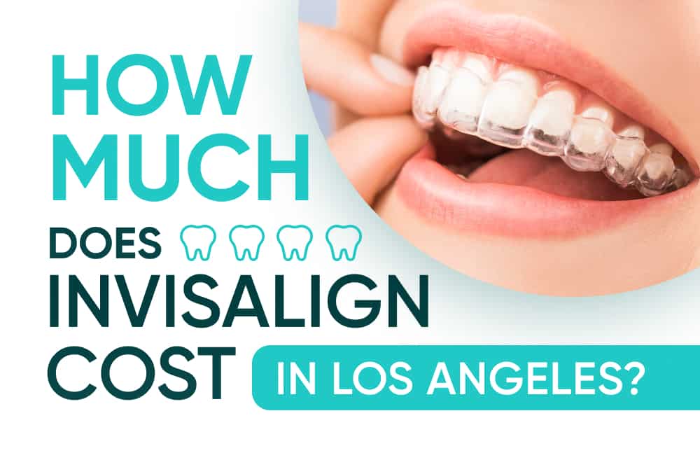 Invisalign Cost Near Me